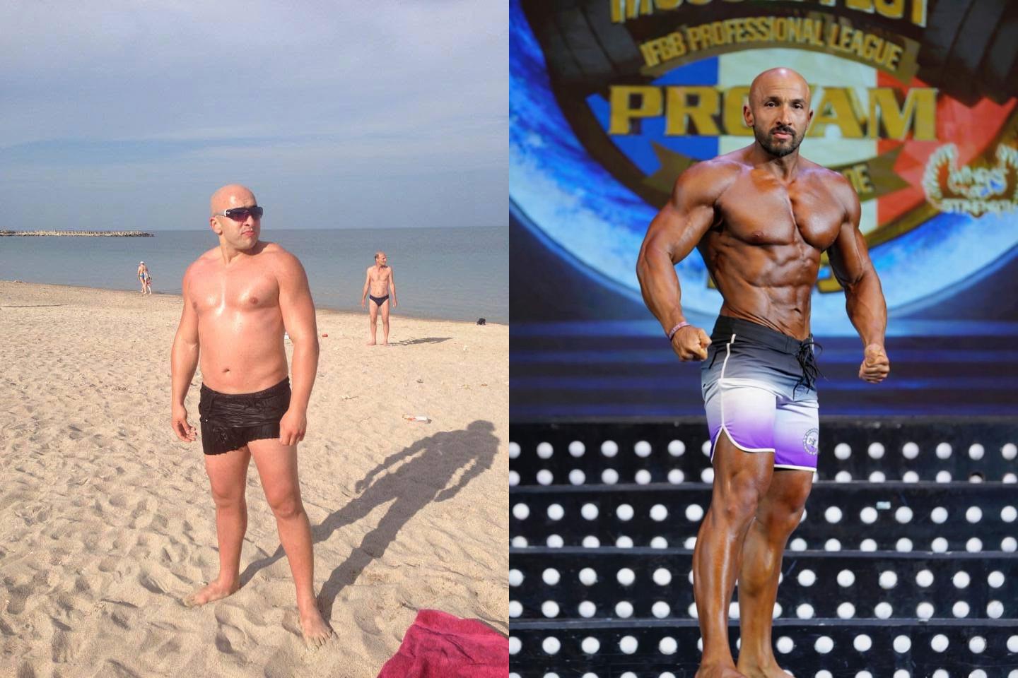 Murat Naser Before & After