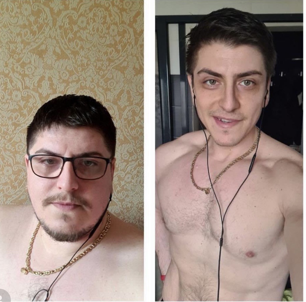 Silviu – Before & After